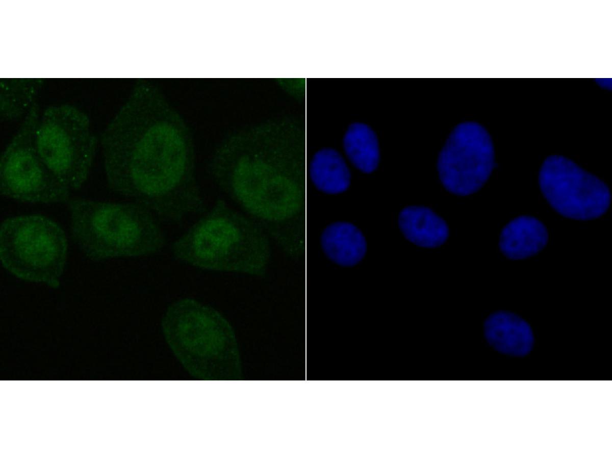 ICC staining of SET in MCF-7 cells (green). Formalin fixed cells were permeabilized with 0.1% Triton X-100 in TBS for 10 minutes at room temperature and blocked with 1% Blocker BSA for 15 minutes at room temperature. Cells were probed with the primary antibody (ET7107-18, 1/50) for 1 hour at room temperature, washed with PBS. Alexa Fluor®488 Goat anti-Rabbit IgG was used as the secondary antibody at 1/1,000 dilution. The nuclear counter stain is DAPI (blue).