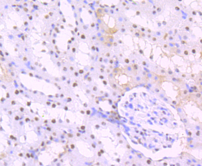 Immunohistochemical analysis of paraffin-embedded rat kidney tissue using anti-SET antibody. The section was pre-treated using heat mediated antigen retrieval with Tris-EDTA buffer (pH 8.0-8.4) for 20 minutes.The tissues were blocked in 5% BSA for 30 minutes at room temperature, washed with ddH2O and PBS, and then probed with the primary antibody (ET7107-18, 1/50) for 30 minutes at room temperature. The detection was performed using an HRP conjugated compact polymer system. DAB was used as the chromogen. Tissues were counterstained with hematoxylin and mounted with DPX.