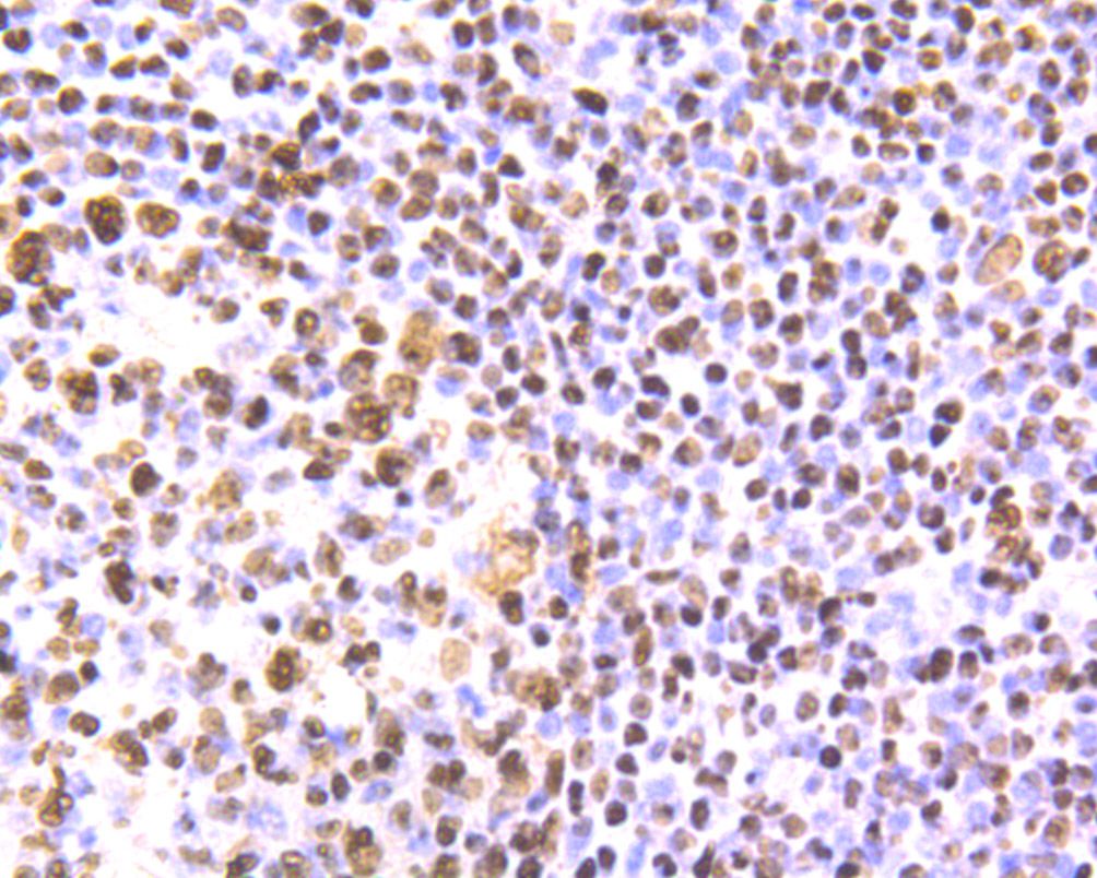 Immunohistochemical analysis of paraffin-embedded human tonsil tissue using anti-SET antibody. The section was pre-treated using heat mediated antigen retrieval with Tris-EDTA buffer (pH 8.0-8.4) for 20 minutes.The tissues were blocked in 5% BSA for 30 minutes at room temperature, washed with ddH2O and PBS, and then probed with the primary antibody (ET7107-18, 1/50) for 30 minutes at room temperature. The detection was performed using an HRP conjugated compact polymer system. DAB was used as the chromogen. Tissues were counterstained with hematoxylin and mounted with DPX.