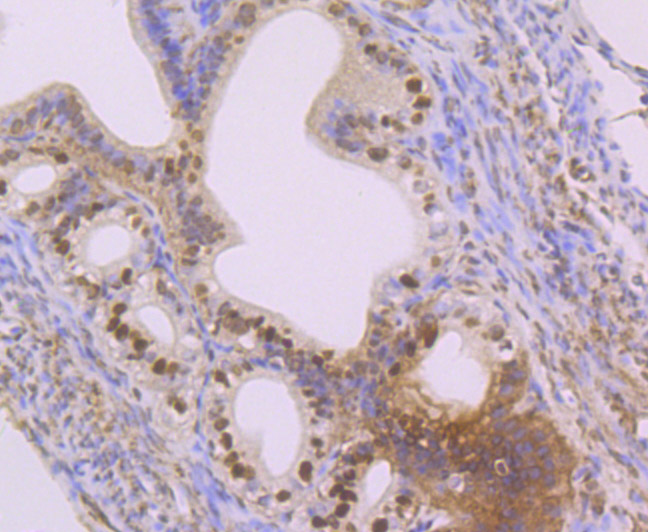 Immunohistochemical analysis of paraffin-embedded mouse fallopian tube tissue using anti-SET antibody. The section was pre-treated using heat mediated antigen retrieval with Tris-EDTA buffer (pH 8.0-8.4) for 20 minutes.The tissues were blocked in 5% BSA for 30 minutes at room temperature, washed with ddH2O and PBS, and then probed with the primary antibody (ET7107-18, 1/50) for 30 minutes at room temperature. The detection was performed using an HRP conjugated compact polymer system. DAB was used as the chromogen. Tissues were counterstained with hematoxylin and mounted with DPX.