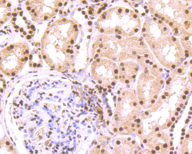 Immunohistochemical analysis of paraffin-embedded human kidney tissue using anti-SET antibody. The section was pre-treated using heat mediated antigen retrieval with Tris-EDTA buffer (pH 8.0-8.4) for 20 minutes.The tissues were blocked in 5% BSA for 30 minutes at room temperature, washed with ddH2O and PBS, and then probed with the primary antibody (ET7107-18, 1/50) for 30 minutes at room temperature. The detection was performed using an HRP conjugated compact polymer system. DAB was used as the chromogen. Tissues were counterstained with hematoxylin and mounted with DPX.