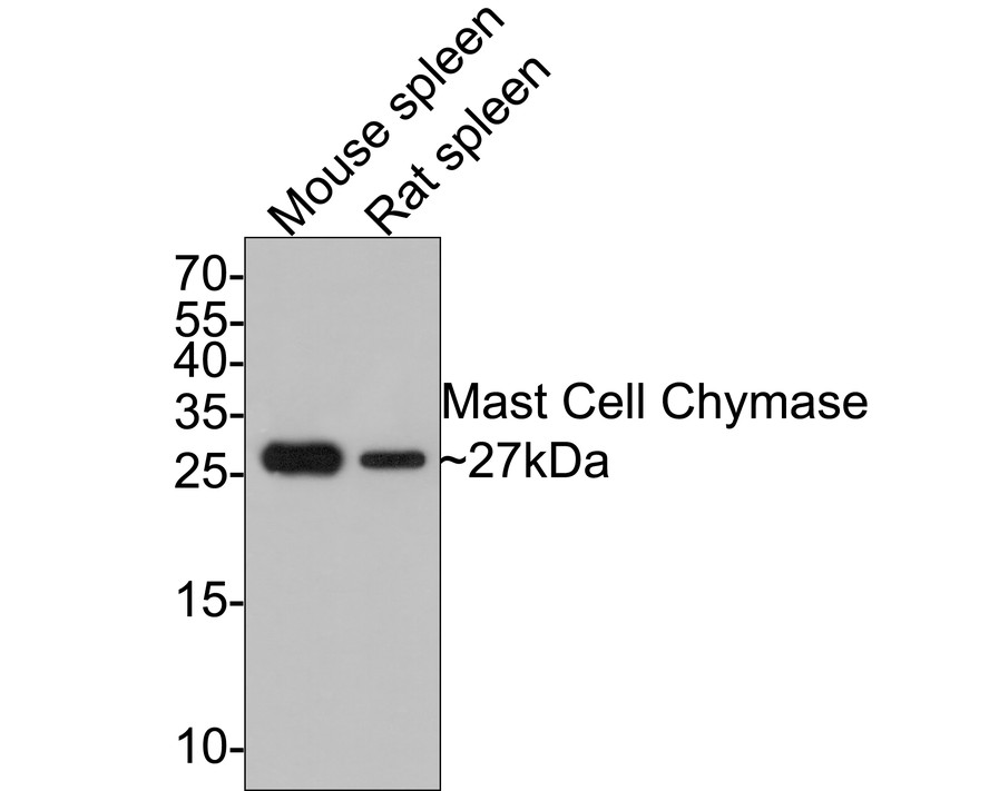 Western blot analysis of Mast Cell Chymase on different lysates with Rabbit anti-Mast Cell Chymase antibody (ET7107-19) at 1/500 dilution.<br />
<br />
Lane 1: Mouse spleen tissue lysate<br />
Lane 2: Rat spleen tissue lysate<br />
<br />
Lysates/proteins at 20 µg/Lane.<br />
<br />
Predicted band size: 27 kDa<br />
Observed band size: 27 kDa<br />
<br />
Exposure time: 2 minutes;<br />
<br />
15% SDS-PAGE gel.<br />
<br />
Proteins were transferred to a PVDF membrane and blocked with 5% NFDM/TBST for 1 hour at room temperature. The primary antibody (ET7107-19) at 1/500 dilution was used in 5% NFDM/TBST at room temperature for 2 hours. Goat Anti-Rabbit IgG - HRP Secondary Antibody (HA1001) at 1:300,000 dilution was used for 1 hour at room temperature.