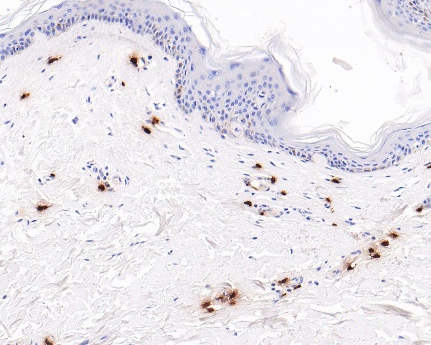 Immunohistochemical analysis of paraffin-embedded human skin tissue using anti-Mast Cell Chymase antibody. The section was pre-treated using heat mediated antigen retrieval with Tris-EDTA buffer (pH 8.0-8.4) for 20 minutes.The tissues were blocked in 5% BSA for 30 minutes at room temperature, washed with ddH2O and PBS, and then probed with the primary antibody (ET7107-19, 1/200) for 30 minutes at room temperature. The detection was performed using an HRP conjugated compact polymer system. DAB was used as the chromogen. Tissues were counterstained with hematoxylin and mounted with DPX.