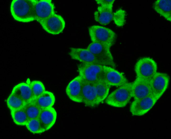 ICC staining Wnt2b in LOVO cells (green). The nuclear counter stain is DAPI (blue). Cells were fixed in paraformaldehyde, permeabilised with 0.25% Triton X100/PBS.