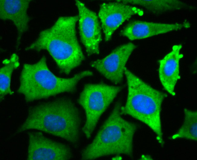 ICC staining Wnt2b in SHSY-5Y cells (green). The nuclear counter stain is DAPI (blue). Cells were fixed in paraformaldehyde, permeabilised with 0.25% Triton X100/PBS.