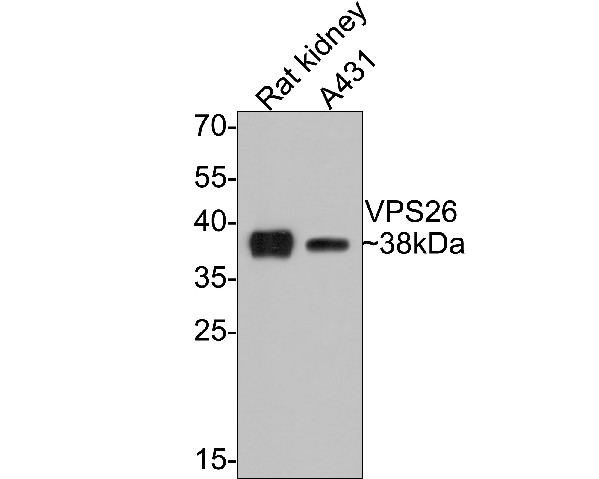 Western blot analysis of VPS26 on different lysates with Rabbit anti-VPS26 antibody (ET7107-21) at 1/500 dilution.<br />
<br />
Lane 1: Human liver tissue lysate (20 µg/Lane)<br />
Lane 2: Hela cell lysate (10 µg/Lane)<br />
<br />
Predicted band size: 38 kDa<br />
Observed band size: 38 kDa<br />
<br />
Exposure time: 2 minutes;<br />
<br />
12% SDS-PAGE gel.<br />
<br />
Proteins were transferred to a PVDF membrane and blocked with 5% NFDM/TBST for 1 hour at room temperature. The primary antibody (ET7107-21) at 1/500 dilution was used in 5% NFDM/TBST at room temperature for 2 hours. Goat Anti-Rabbit IgG - HRP Secondary Antibody (HA1001) at 1:300,000 dilution was used for 1 hour at room temperature.