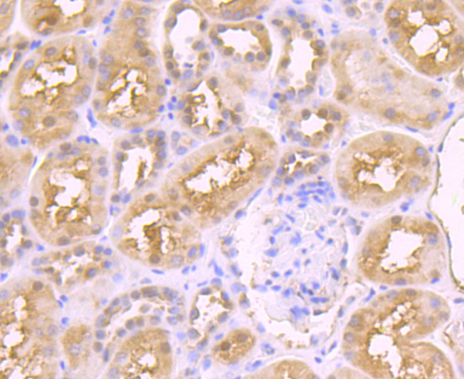 ICC staining JAB1 in A549 cells (green). The nuclear counter stain is DAPI (blue). Cells were fixed in paraformaldehyde, permeabilised with 0.25% Triton X100/PBS.