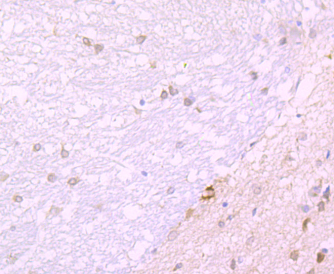 Immunohistochemical analysis of paraffin-embedded rat brain tissue using anti-JAB1 antibody. Counter stained with hematoxylin.