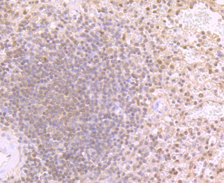 Immunohistochemical analysis of paraffin-embedded human spleen tissue with Rabbit anti-Proteasome 20S LMP2 antibody (ET7107-24) at 1/200 dilution.<br />
<br />
The section was pre-treated using heat mediated antigen retrieval with Tris-EDTA buffer (pH 9.0) for 20 minutes. The tissues were blocked in 1% BSA for 20 minutes at room temperature, washed with ddH2O and PBS, and then probed with the primary antibody (ET7107-24) at 1/200 dilution for 1 hour at room temperature. The detection was performed using an HRP conjugated compact polymer system. DAB was used as the chromogen. Tissues were counterstained with hematoxylin and mounted with DPX.