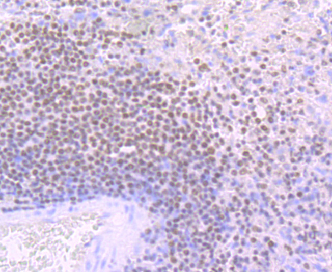 Immunohistochemical analysis of paraffin-embedded human spleen tissue using anti-Ikaros antibody. Counter stained with hematoxylin.