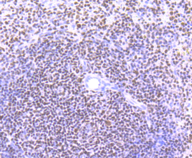 Immunohistochemical analysis of paraffin-embedded mouse spleen tissue using anti-Ikaros antibody. Counter stained with hematoxylin.