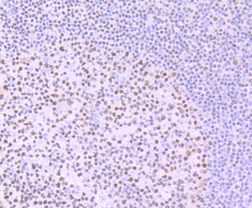 Immunohistochemical analysis of paraffin-embedded human tonsil tissue using anti-Ikaros antibody. Counter stained with hematoxylin.