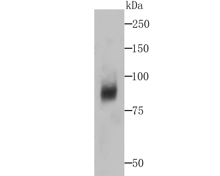 Western blot analysis of Dcp1a on human liver tissue lysates. Proteins were transferred to a PVDF membrane and blocked with 5% BSA in PBS for 1 hour at room temperature. The primary antibody (ET7107-26, 1/500) was used in 5% BSA at room temperature for 2 hours. Goat Anti-Rabbit IgG - HRP Secondary Antibody (HA1001) at 1:200,000 dilution was used for 1 hour at room temperature.