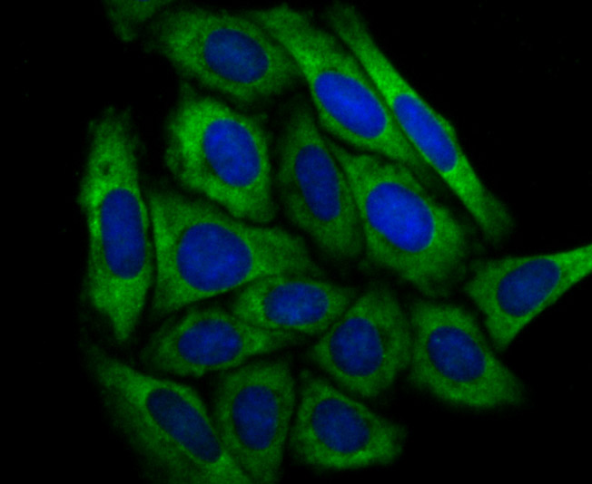 ICC staining of Dcp1a in SiHa cells (green). Formalin fixed cells were permeabilized with 0.1% Triton X-100 in TBS for 10 minutes at room temperature and blocked with 10% negative goat serum for 15 minutes at room temperature. Cells were probed with the primary antibody (ET7107-26, 1/50) for 1 hour at room temperature, washed with PBS. Alexa Fluor®488 conjugate-Goat anti-Rabbit IgG was used as the secondary antibody at 1/1,000 dilution. The nuclear counter stain is DAPI (blue).