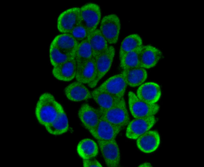 ICC staining of Dcp1a in LOVO cells (green). Formalin fixed cells were permeabilized with 0.1% Triton X-100 in TBS for 10 minutes at room temperature and blocked with 10% negative goat serum for 15 minutes at room temperature. Cells were probed with the primary antibody (ET7107-26, 1/50) for 1 hour at room temperature, washed with PBS. Alexa Fluor®488 conjugate-Goat anti-Rabbit IgG was used as the secondary antibody at 1/1,000 dilution. The nuclear counter stain is DAPI (blue).