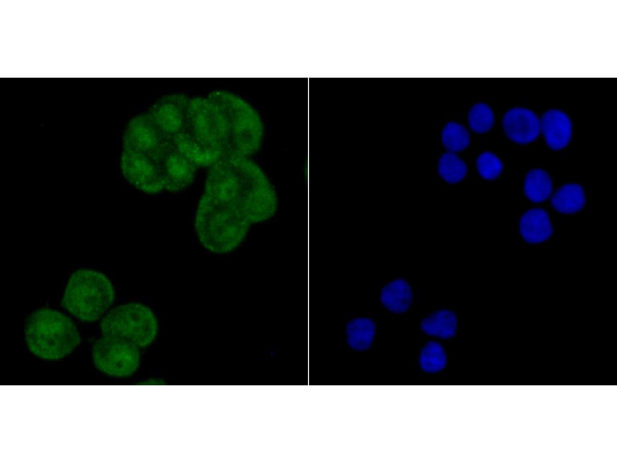 ICC staining of CRM1 in LOVO cells (green). Formalin fixed cells were permeabilized with 0.1% Triton X-100 in TBS for 10 minutes at room temperature and blocked with 10% negative goat serum for 15 minutes at room temperature. Cells were probed with the primary antibody (ET7107-27, 1/50) for 1 hour at room temperature, washed with PBS. Alexa Fluor®488 conjugate-Goat anti-Rabbit IgG was used as the secondary antibody at 1/1,000 dilution. The nuclear counter stain is DAPI (blue).