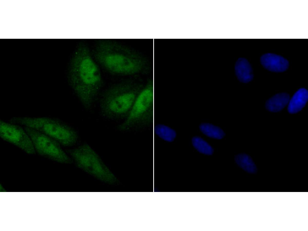 ICC staining of CRM1 in SiHa cells (green). Formalin fixed cells were permeabilized with 0.1% Triton X-100 in TBS for 10 minutes at room temperature and blocked with 10% negative goat serum for 15 minutes at room temperature. Cells were probed with the primary antibody (ET7107-27, 1/50) for 1 hour at room temperature, washed with PBS. Alexa Fluor®488 conjugate-Goat anti-Rabbit IgG was used as the secondary antibody at 1/1,000 dilution. The nuclear counter stain is DAPI (blue).