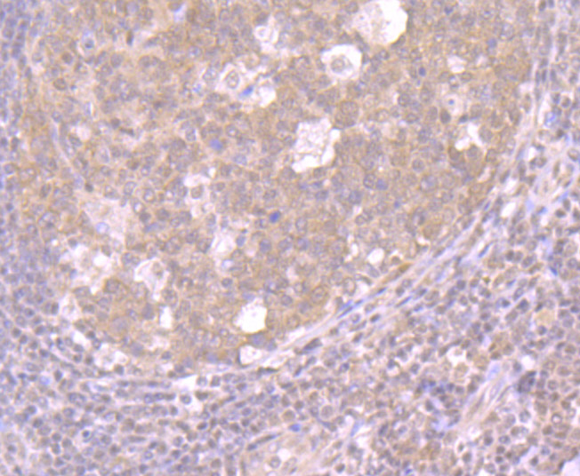 Immunohistochemical analysis of paraffin-embedded human tonsil tissue using anti-CRM1 antibody. The section was pre-treated using heat mediated antigen retrieval with Tris-EDTA buffer (pH 9.0) for 20 minutes.The tissues were blocked in 1% BSA for 30 minutes at room temperature, washed with ddH2O and PBS, and then probed with the primary antibody (ET7107-27, 1/50) for 30 minutes at room temperature. The detection was performed using an HRP conjugated compact polymer system. DAB was used as the chromogen. Tissues were counterstained with hematoxylin and mounted with DPX.
