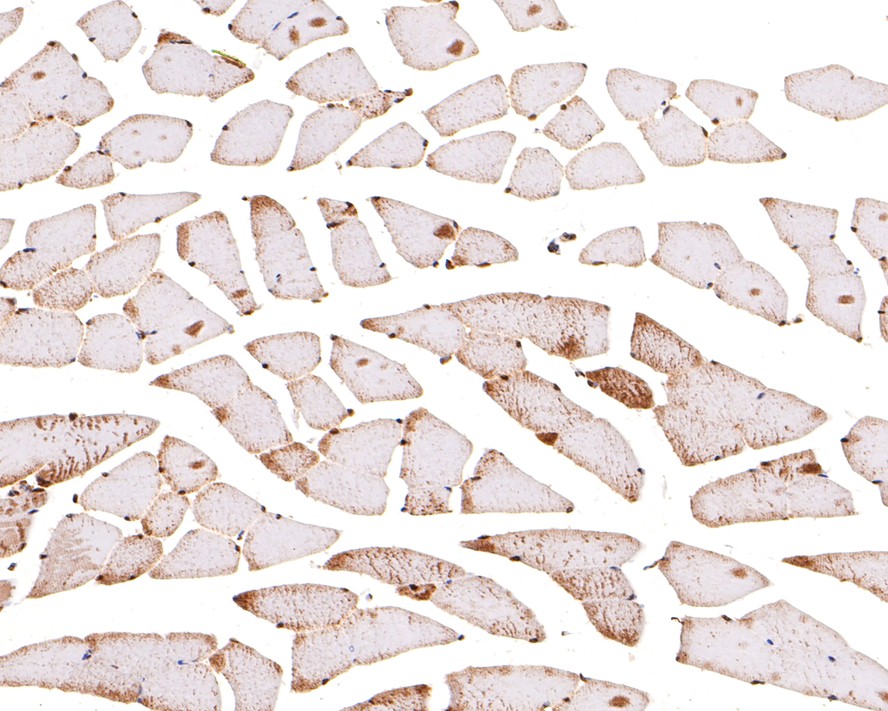 Immunohistochemical analysis of paraffin-embedded mouse skeletal muscle tissue with Rabbit anti-CRM1 antibody (ET7107-27) at 1/100 dilution.<br />
<br />
The section was pre-treated using heat mediated antigen retrieval with sodium citrate buffer (pH 6.0) for 2 minutes. The tissues were blocked in 1% BSA for 20 minutes at room temperature, washed with ddH2O and PBS, and then probed with the primary antibody (ET7107-27) at 1/100 dilution for 1 hour at room temperature. The detection was performed using an HRP conjugated compact polymer system. DAB was used as the chromogen. Tissues were counterstained with hematoxylin and mounted with DPX.