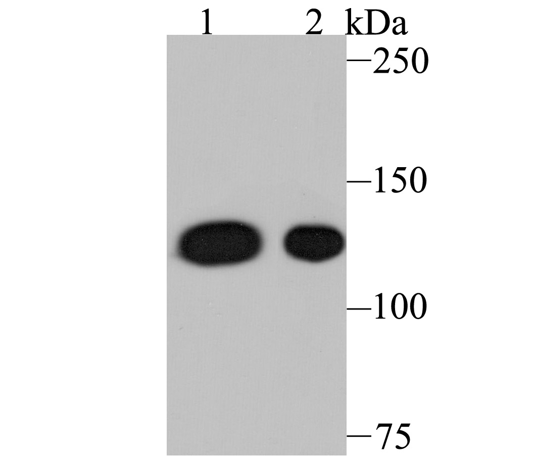 Western blot analysis of Nesprin 1 on different lysates using anti-Nesprin 1 antibody at 1/500 dilution.<br />
 Positive control:<br />
 Lane 1: A549 cell lysate<br />
 Lane 2: Mouse spleen tissue lysate