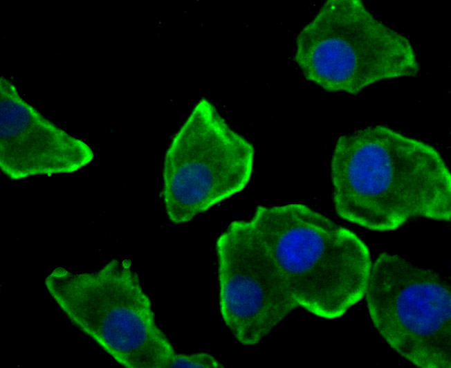 ICC staining Nesprin 1 in A549 cells (green). The nuclear counter stain is DAPI (blue). Cells were fixed in paraformaldehyde, permeabilised with 0.25% Triton X100/PBS.