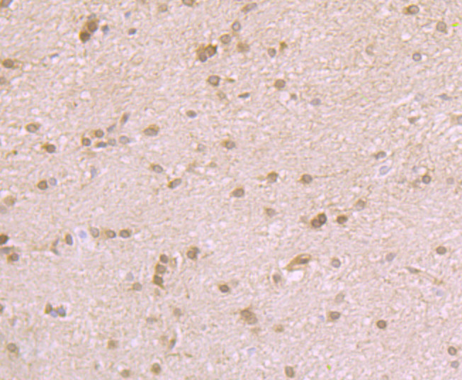 Immunohistochemical analysis of paraffin-embedded rat brain tissue using anti-Nesprin 1 antibody. Counter stained with hematoxylin.