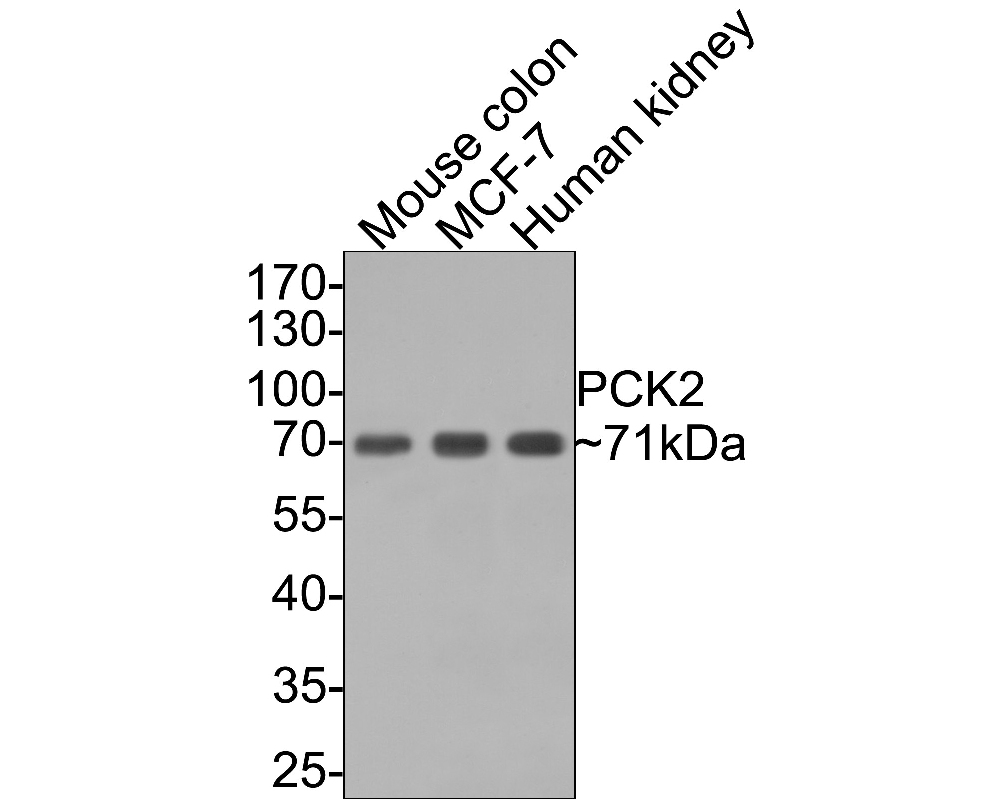 Western blot analysis of PCK2 on different lysates with Rabbit anti-PCK2 antibody (ET7107-29) at 1/500 dilution.<br />
<br />
Lane 1: Mouse colon tissue lysate (20 µg/Lane)<br />
Lane 2: MCF-7 cell lysate (10 µg/Lane)<br />
Lane 3: Human kidney tissue lysate (20 µg/Lane)<br />
<br />
Predicted band size: 71 kDa<br />
Observed band size: 71 kDa<br />
<br />
Exposure time: 1 minute;<br />
<br />
10% SDS-PAGE gel.<br />
<br />
Proteins were transferred to a PVDF membrane and blocked with 5% NFDM/TBST for 1 hour at room temperature. The primary antibody (ET7107-29) at 1/500 dilution was used in 5% NFDM/TBST at room temperature for 2 hours. Goat Anti-Rabbit IgG - HRP Secondary Antibody (HA1001) at 1:300,000 dilution was used for 1 hour at room temperature.