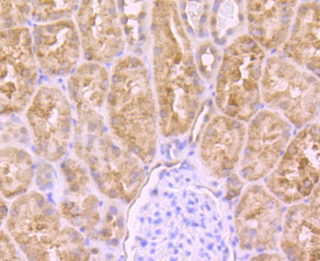 Immunohistochemical analysis of paraffin-embedded human kidney tissue using anti-PCK2 antibody. Counter stained with hematoxylin.