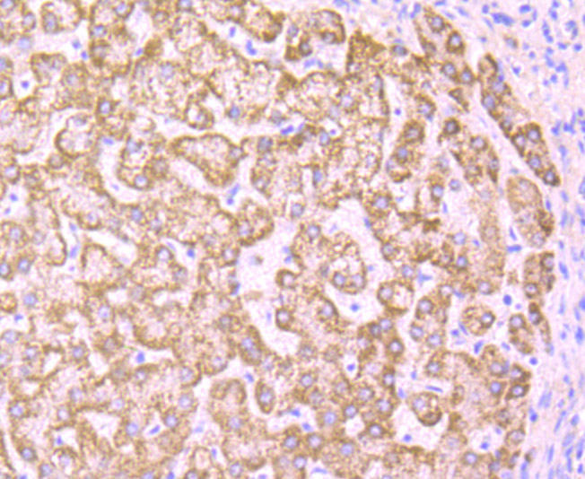 Immunohistochemical analysis of paraffin-embedded human liver tissue using anti-PCK2 antibody. Counter stained with hematoxylin.