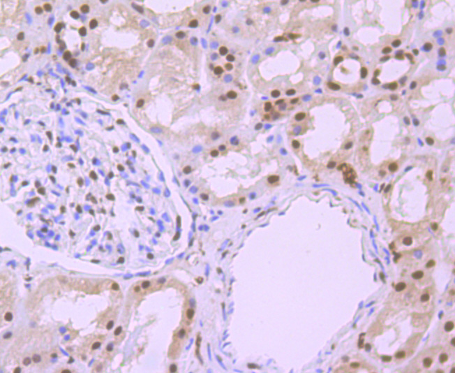 Immunohistochemical analysis of paraffin-embedded rat brain tissue using anti-Phospho-alpha Synuclein (S129) antibody. The section was pre-treated using heat mediated antigen retrieval with Tris-EDTA buffer (pH 9.0) for 20 minutes.The tissues were blocked in 1% BSA for 30 minutes at room temperature, washed with ddH2O and PBS, and then probed with the primary antibody (ET7107-30, 1/50) for 30 minutes at room temperature. The detection was performed using an HRP conjugated compact polymer system. DAB was used as the chromogen. Tissues were counterstained with hematoxylin and mounted with DPX.