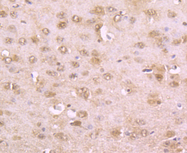 Immunohistochemical analysis of paraffin-embedded mouse brain tissue using anti-Phospho-alpha Synuclein (S129) antibody. The section was pre-treated using heat mediated antigen retrieval with Tris-EDTA buffer (pH 9.0) for 20 minutes.The tissues were blocked in 1% BSA for 30 minutes at room temperature, washed with ddH2O and PBS, and then probed with the primary antibody (ET7107-30, 1/50) for 30 minutes at room temperature. The detection was performed using an HRP conjugated compact polymer system. DAB was used as the chromogen. Tissues were counterstained with hematoxylin and mounted with DPX.