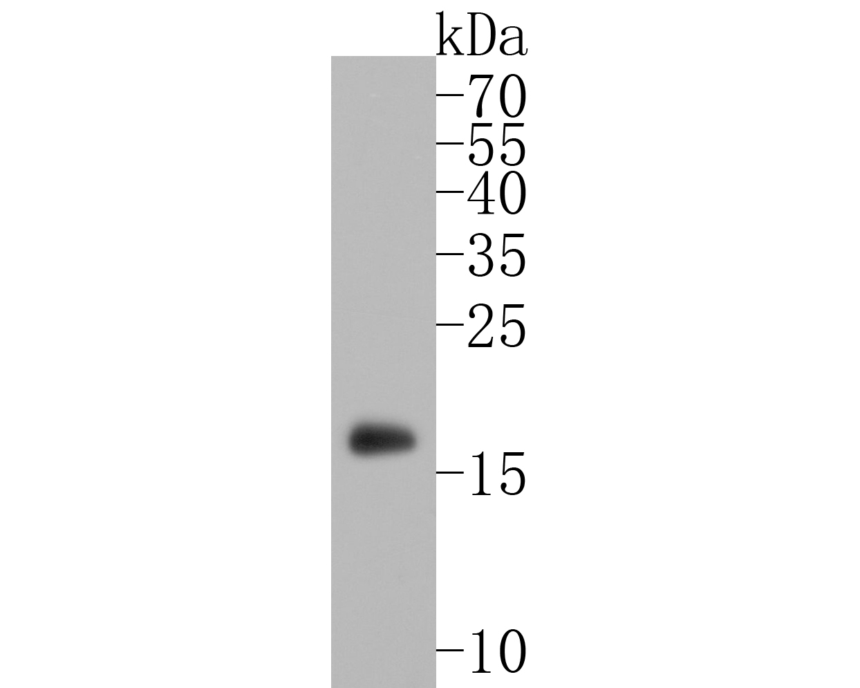 Western blot analysis of Alpha Synuclein on human brain tissue lysates. Proteins were transferred to a PVDF membrane and blocked with 5% BSA in PBS for 1 hour at room temperature. The primary antibody (ET7107-31, 1/500) was used in 5% BSA at room temperature for 2 hours. Goat Anti-Rabbit IgG - HRP Secondary Antibody (HA1001) at 1:5,000 dilution was used for 1 hour at room temperature.