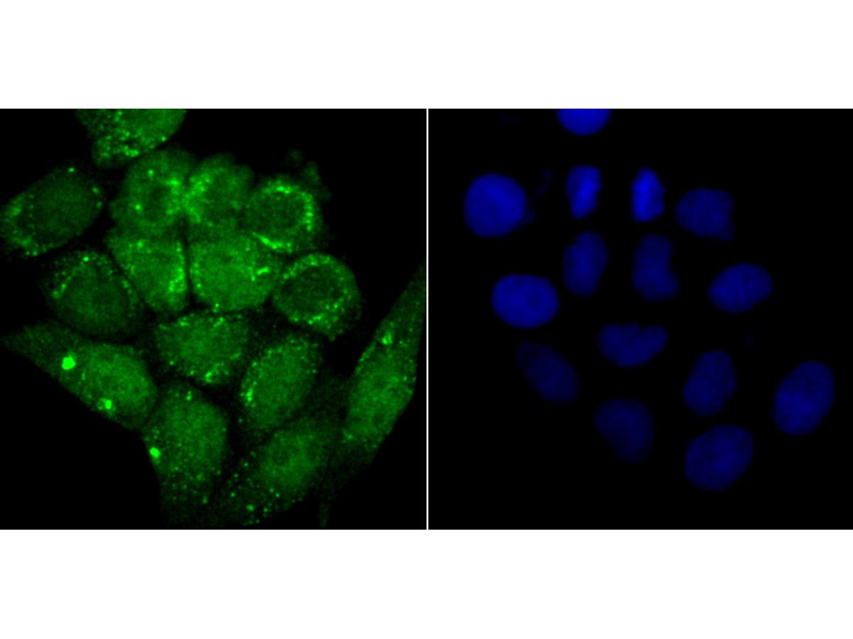 ICC staining of Alpha Synuclein in Hela cells (green). Formalin fixed cells were permeabilized with 0.1% Triton X-100 in TBS for 10 minutes at room temperature and blocked with 1% Blocker BSA for 15 minutes at room temperature. Cells were probed with the primary antibody (ET7107-31, 1/50) for 1 hour at room temperature, washed with PBS. Alexa Fluor®488 Goat anti-Rabbit IgG was used as the secondary antibody at 1/1,000 dilution. The nuclear counter stain is DAPI (blue).