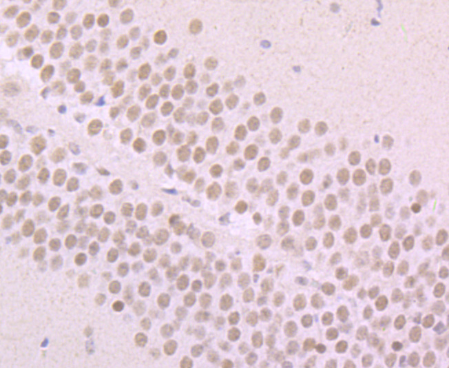 Immunohistochemical analysis of paraffin-embedded mouse brain tissue using anti-Alpha Synuclein antibody. The section was pre-treated using heat mediated antigen retrieval with Tris-EDTA buffer (pH 8.0-8.4) for 20 minutes.The tissues were blocked in 5% BSA for 30 minutes at room temperature, washed with ddH2O and PBS, and then probed with the primary antibody (ET7107-31, 1/50) for 30 minutes at room temperature. The detection was performed using an HRP conjugated compact polymer system. DAB was used as the chromogen. Tissues were counterstained with hematoxylin and mounted with DPX.