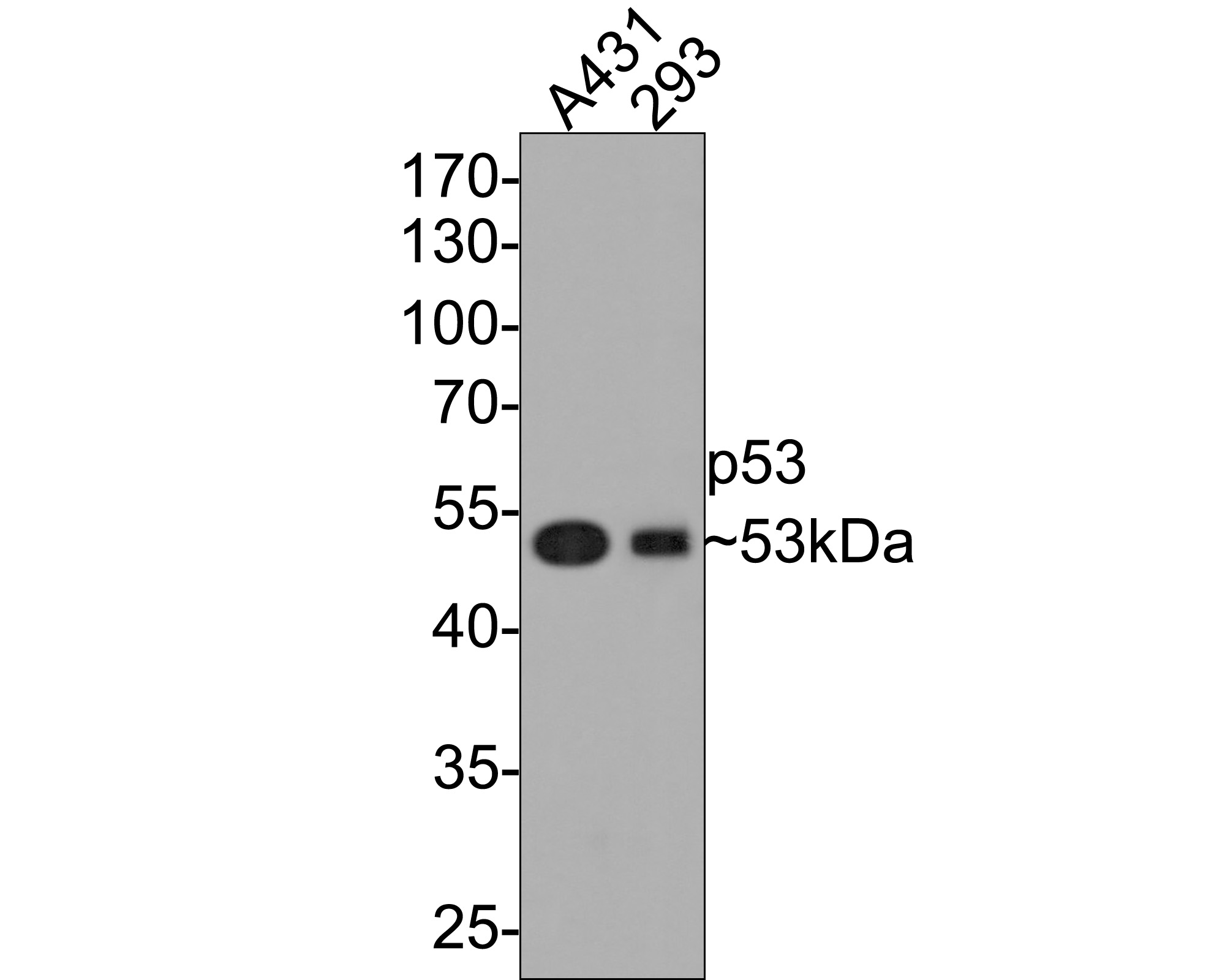 Western blot analysis of Mutant p53 on different lysates with Rabbit anti-Mutant p53 antibody (ET7107-33) at 1/500 dilution.<br />
<br />
Lane 1: A431 cell lysate<br />
Lane 2: 293 cell lysate<br />
<br />
Lysates/proteins at 10 µg/Lane.<br />
<br />
Predicted band size: 44 kDa<br />
Observed band size: 53 kDa<br />
<br />
Exposure time: 2 minutes;<br />
<br />
10% SDS-PAGE gel.<br />
<br />
Proteins were transferred to a PVDF membrane and blocked with 5% NFDM/TBST for 1 hour at room temperature. The primary antibody (ET7107-33) at 1/500 dilution was used in 5% NFDM/TBST at room temperature for 2 hours. Goat Anti-Rabbit IgG - HRP Secondary Antibody (HA1001) at 1:300,000 dilution was used for 1 hour at room temperature.