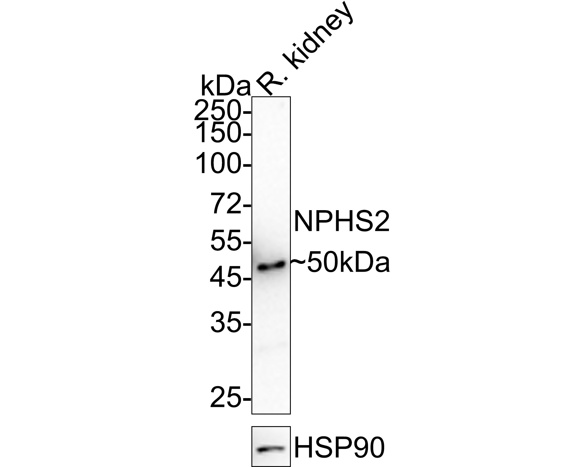 Western blot analysis of NPHS2 on different lysates with Rabbit anti-NPHS2 antibody (ET7107-34) at 1/500 dilution.<br />
<br />
Lane 1: Human kidney tissue lysate<br />
Lane 2: Mouse kidney tissue lysate<br />
<br />
Lysates/proteins at 20 µg/Lane.<br />
<br />
Predicted band size: 42 kDa<br />
Observed band size: 50 kDa<br />
<br />
Exposure time: 4 minutes;<br />
<br />
10% SDS-PAGE gel.<br />
<br />
Proteins were transferred to a PVDF membrane and blocked with 5% NFDM/TBST for 1 hour at room temperature. The primary antibody (ET7107-34) at 1/500 dilution was used in 5% NFDM/TBST at room temperature for 2 hours. Goat Anti-Rabbit IgG - HRP Secondary Antibody (HA1001) at 1:200,000 dilution was used for 1 hour at room temperature.