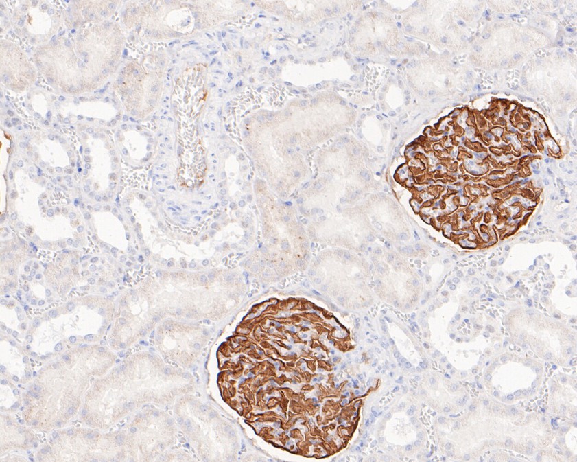 Immunohistochemical analysis of paraffin-embedded human kidney tissue using anti-NPHS2 antibody. The section was pre-treated using heat mediated antigen retrieval with sodium citrate buffer (pH 6.0) for 20 minutes. The tissues were blocked in 5% BSA for 30 minutes at room temperature, washed with ddH2O and PBS, and then probed with the primary antibody (ET7107-34, 1/200)  for 30 minutes at room temperature. The detection was performed using an HRP conjugated compact polymer system. DAB was used as the chromogen. Tissues were counterstained with hematoxylin and mounted with DPX.