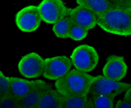 ICC staining of Cytochrome P450 Reductase in LOVO cells (green). Formalin fixed cells were permeabilized with 0.1% Triton X-100 in TBS for 10 minutes at room temperature and blocked with 1% Blocker BSA for 15 minutes at room temperature. Cells were probed with the primary antibody (ET7107-35, 1/50) for 1 hour at room temperature, washed with PBS. Alexa Fluor®488 Goat anti-Rabbit IgG was used as the secondary antibody at 1/1,000 dilution. The nuclear counter stain is DAPI (blue).