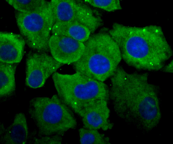 ICC staining of Cytochrome P450 Reductase in A549 cells (green). Formalin fixed cells were permeabilized with 0.1% Triton X-100 in TBS for 10 minutes at room temperature and blocked with 1% Blocker BSA for 15 minutes at room temperature. Cells were probed with the primary antibody (ET7107-35, 1/50) for 1 hour at room temperature, washed with PBS. Alexa Fluor®488 Goat anti-Rabbit IgG was used as the secondary antibody at 1/1,000 dilution. The nuclear counter stain is DAPI (blue).
