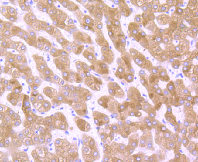 Immunohistochemical analysis of paraffin-embedded human liver tissue using anti-Cytochrome P450 Reductase antibody. The section was pre-treated using heat mediated antigen retrieval with Tris-EDTA buffer (pH 8.0-8.4) for 20 minutes.The tissues were blocked in 5% BSA for 30 minutes at room temperature, washed with ddH2O and PBS, and then probed with the primary antibody (ET7107-35, 1/50) for 30 minutes at room temperature. The detection was performed using an HRP conjugated compact polymer system. DAB was used as the chromogen. Tissues were counterstained with hematoxylin and mounted with DPX.
