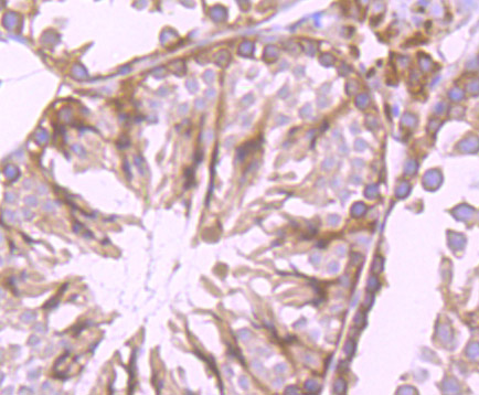 Immunohistochemical analysis of paraffin-embedded mouse testis tissue using anti-Cytochrome P450 Reductase antibody. The section was pre-treated using heat mediated antigen retrieval with Tris-EDTA buffer (pH 8.0-8.4) for 20 minutes.The tissues were blocked in 5% BSA for 30 minutes at room temperature, washed with ddH2O and PBS, and then probed with the primary antibody (ET7107-35, 1/50) for 30 minutes at room temperature. The detection was performed using an HRP conjugated compact polymer system. DAB was used as the chromogen. Tissues were counterstained with hematoxylin and mounted with DPX.