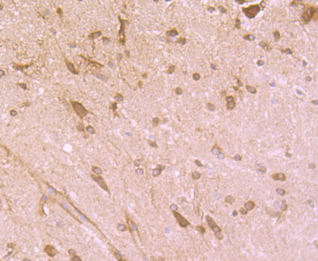 Immunohistochemical analysis of paraffin-embedded rat brain tissue using anti-Cytochrome P450 Reductase antibody. The section was pre-treated using heat mediated antigen retrieval with Tris-EDTA buffer (pH 8.0-8.4) for 20 minutes.The tissues were blocked in 5% BSA for 30 minutes at room temperature, washed with ddH2O and PBS, and then probed with the primary antibody (ET7107-35, 1/50) for 30 minutes at room temperature. The detection was performed using an HRP conjugated compact polymer system. DAB was used as the chromogen. Tissues were counterstained with hematoxylin and mounted with DPX.