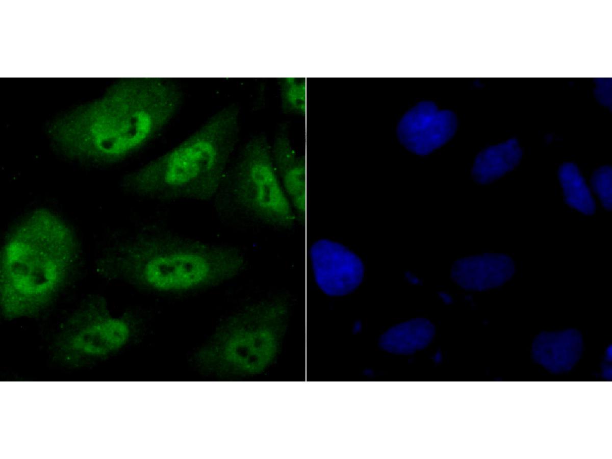 ICC staining of Proteasome 20S LMP7 in HUVEC cells (green). Formalin fixed cells were permeabilized with 0.1% Triton X-100 in TBS for 10 minutes at room temperature and blocked with 10% negative goat serum for 15 minutes at room temperature. Cells were probed with the primary antibody (ET7107-36, 1/50) for 1 hour at room temperature, washed with PBS. Alexa Fluor®488 conjugate-Goat anti-Rabbit IgG was used as the secondary antibody at 1/1,000 dilution. The nuclear counter stain is DAPI (blue).