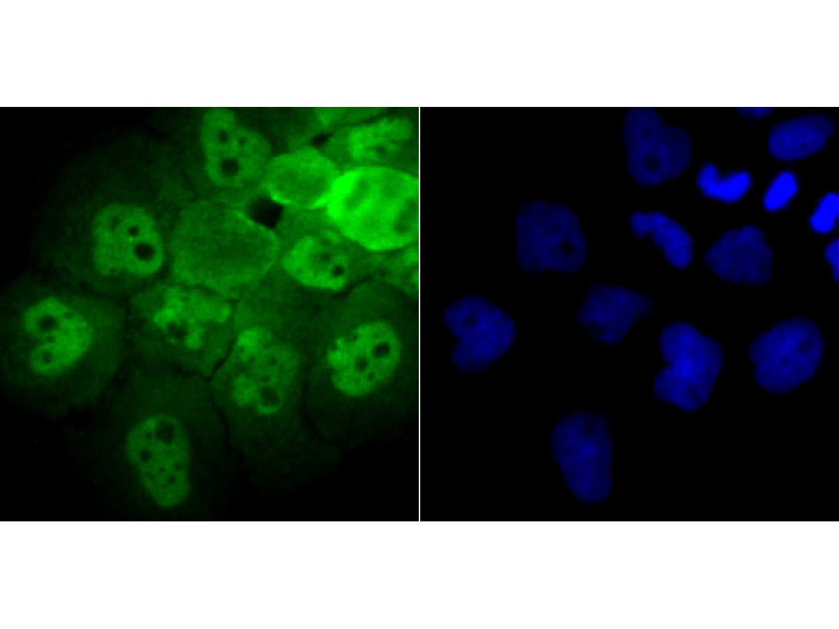 ICC staining of Proteasome 20S LMP7 in A431 cells (green). Formalin fixed cells were permeabilized with 0.1% Triton X-100 in TBS for 10 minutes at room temperature and blocked with 10% negative goat serum for 15 minutes at room temperature. Cells were probed with the primary antibody (ET7107-36, 1/50) for 1 hour at room temperature, washed with PBS. Alexa Fluor®488 conjugate-Goat anti-Rabbit IgG was used as the secondary antibody at 1/1,000 dilution. The nuclear counter stain is DAPI (blue).