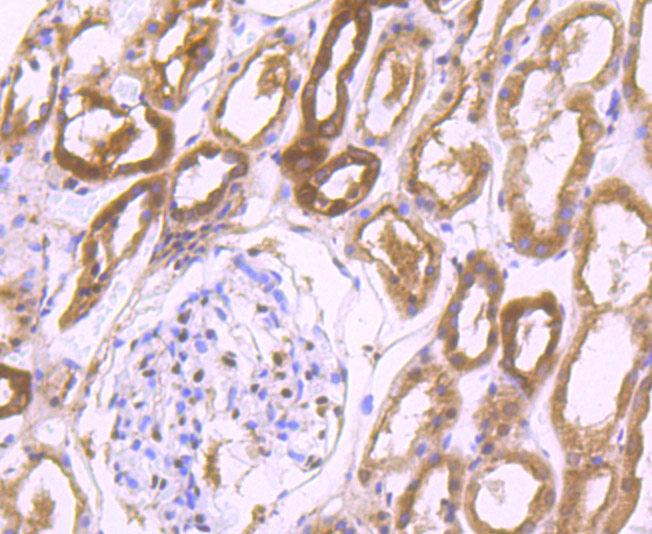 Immunohistochemical analysis of paraffin-embedded human kidney tissue using anti-Proteasome 20S LMP7 antibody. The section was pre-treated using heat mediated antigen retrieval with Tris-EDTA buffer (pH 9.0) for 20 minutes.The tissues were blocked in 1% BSA for 30 minutes at room temperature, washed with ddH2O and PBS, and then probed with the primary antibody (ET7107-36, 1/50) for 30 minutes at room temperature. The detection was performed using an HRP conjugated compact polymer system. DAB was used as the chromogen. Tissues were counterstained with hematoxylin and mounted with DPX.
