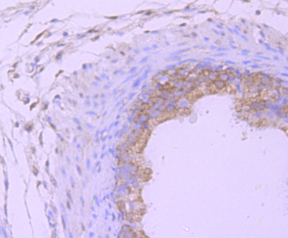 Immunohistochemical analysis of paraffin-embedded rat epididymis tissue using anti-Proteasome 20S LMP7 antibody. The section was pre-treated using heat mediated antigen retrieval with Tris-EDTA buffer (pH 9.0) for 20 minutes.The tissues were blocked in 1% BSA for 30 minutes at room temperature, washed with ddH2O and PBS, and then probed with the primary antibody (ET7107-36, 1/50) for 30 minutes at room temperature. The detection was performed using an HRP conjugated compact polymer system. DAB was used as the chromogen. Tissues were counterstained with hematoxylin and mounted with DPX.