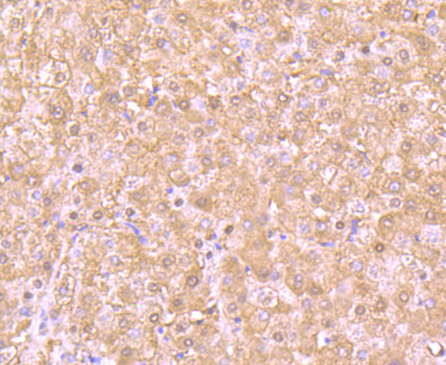 Immunohistochemical analysis of paraffin-embedded human liver tissue using anti-Proteasome 20S LMP7 antibody. The section was pre-treated using heat mediated antigen retrieval with Tris-EDTA buffer (pH 9.0) for 20 minutes.The tissues were blocked in 1% BSA for 30 minutes at room temperature, washed with ddH2O and PBS, and then probed with the primary antibody (ET7107-36, 1/50) for 30 minutes at room temperature. The detection was performed using an HRP conjugated compact polymer system. DAB was used as the chromogen. Tissues were counterstained with hematoxylin and mounted with DPX.