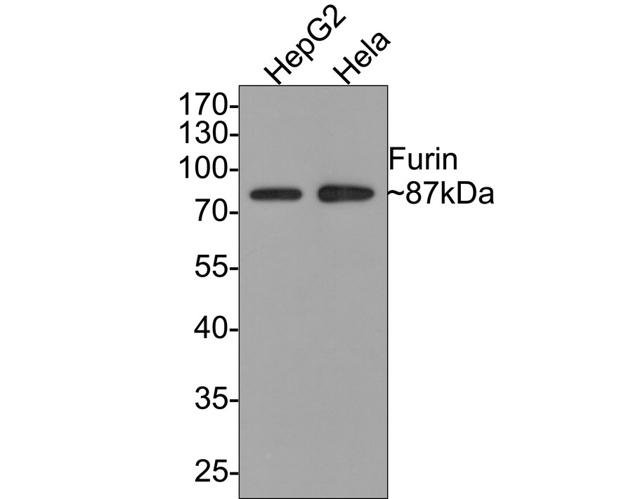 Western blot analysis of Furin on different lysates with Rabbit anti-Furin antibody (ET7107-37) at 1/500 dilution.<br />
<br />
Lane 1: HepG2 cell lysate<br />
Lane 2: Hela cell lysate<br />
<br />
Lysates/proteins at 10 µg/Lane.<br />
<br />
Predicted band size: 87 kDa<br />
Observed band size: 87 kDa<br />
<br />
Exposure time: 1 minute;<br />
<br />
10% SDS-PAGE gel.<br />
<br />
Proteins were transferred to a PVDF membrane and blocked with 5% NFDM/TBST for 1 hour at room temperature. The primary antibody (ET7107-37) at 1/500 dilution was used in 5% NFDM/TBST at room temperature for 2 hours. Goat Anti-Rabbit IgG - HRP Secondary Antibody (HA1001) at 1:300,000 dilution was used for 1 hour at room temperature.