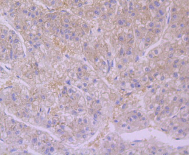 Immunohistochemical analysis of paraffin-embedded human liver tissue using anti-Furin antibody. The section was pre-treated using heat mediated antigen retrieval with Tris-EDTA buffer (pH 8.0-8.4) for 20 minutes.The tissues were blocked in 5% BSA for 30 minutes at room temperature, washed with ddH2O and PBS, and then probed with the primary antibody (ET7107-37, 1/50) for 30 minutes at room temperature. The detection was performed using an HRP conjugated compact polymer system. DAB was used as the chromogen. Tissues were counterstained with hematoxylin and mounted with DPX.