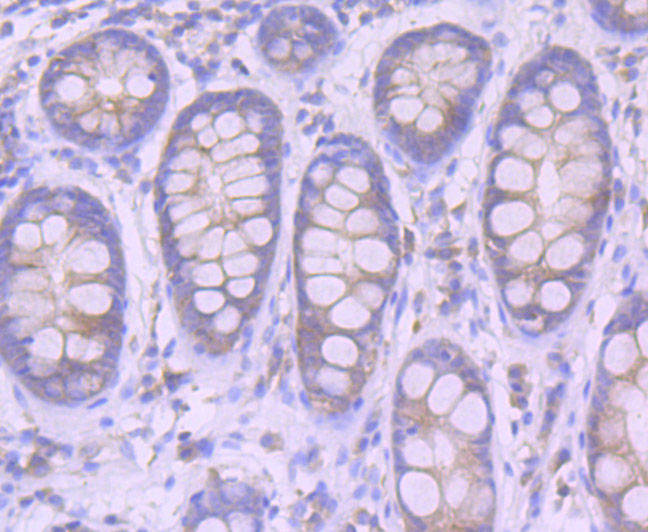 Immunohistochemical analysis of paraffin-embedded human colon tissue using anti-Furin antibody. The section was pre-treated using heat mediated antigen retrieval with Tris-EDTA buffer (pH 8.0-8.4) for 20 minutes.The tissues were blocked in 5% BSA for 30 minutes at room temperature, washed with ddH2O and PBS, and then probed with the primary antibody (ET7107-37, 1/50) for 30 minutes at room temperature. The detection was performed using an HRP conjugated compact polymer system. DAB was used as the chromogen. Tissues were counterstained with hematoxylin and mounted with DPX.